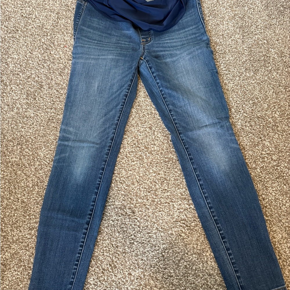 Madewell Women's Maternity Skinny Jeans